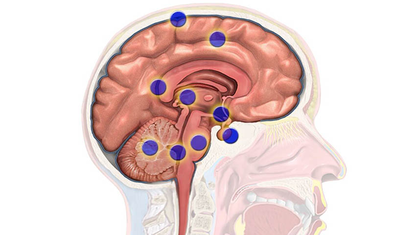 El consorcio Treatbrain, liderado desde la UCLM, recibe 200 000 euros del Gobierno regional para avanzar en la investigación y tratamiento del cáncer cerebral