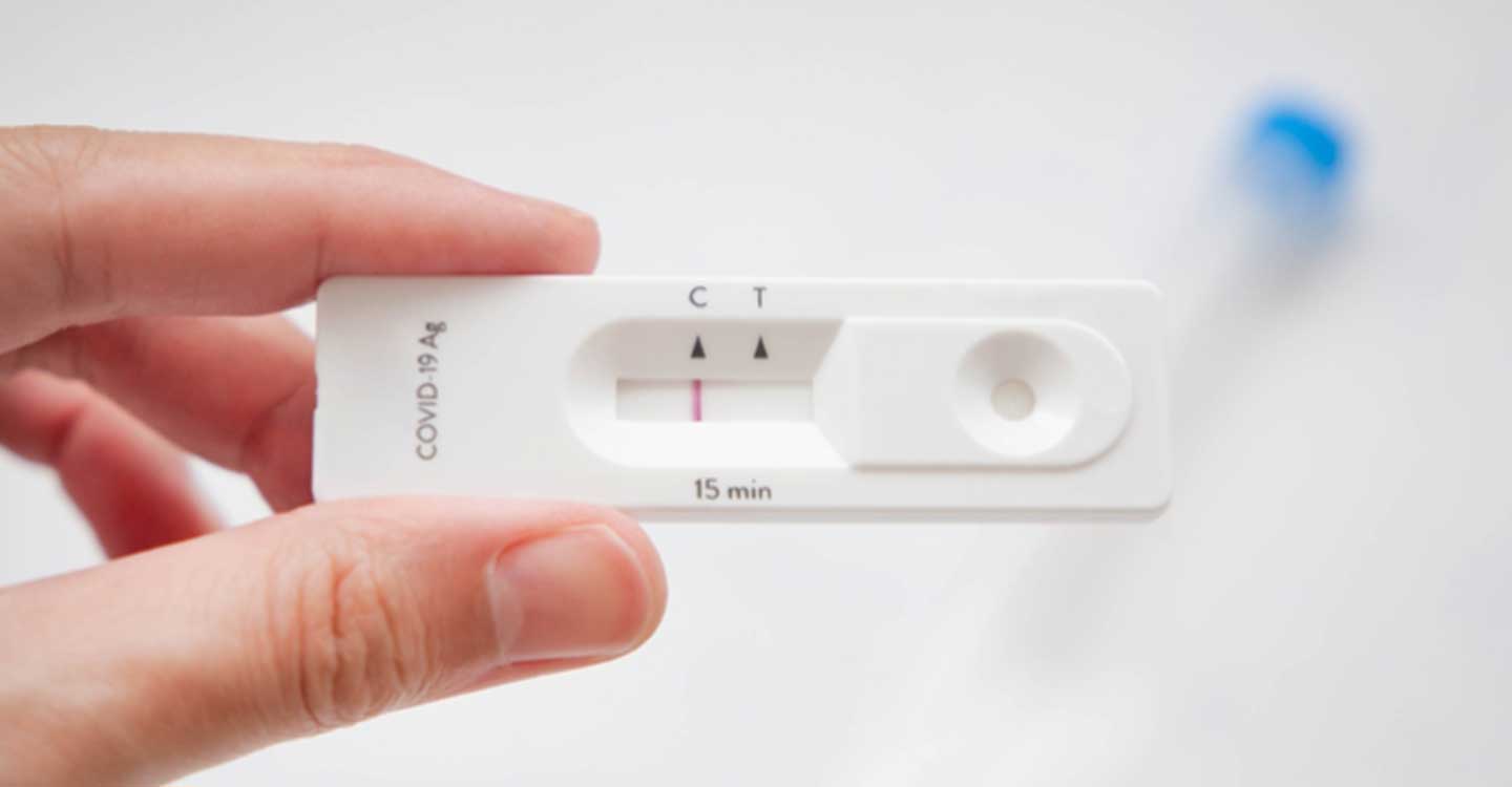 Las farmacias, preparadas para reforzar la capacidad de detección de la COVID-19 con los test de autodiagnóstico