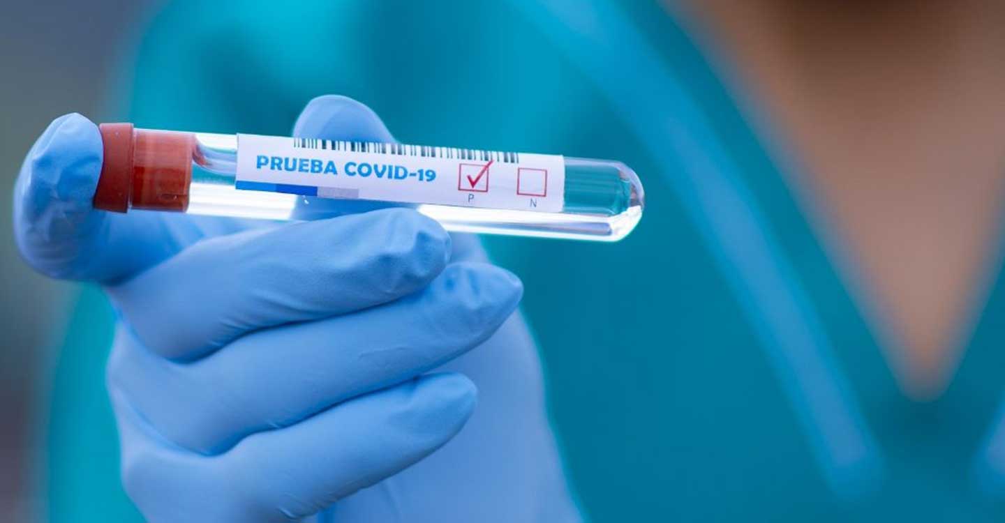 IU C-LM reclama la realización de PCR a los contactos estrechos de pacientes positivos en COVID