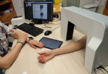 El Hospital Universitario de Toledo incorpora una nueva herramienta digital para la lectura de las pruebas cutáneas del servicio de Alergología