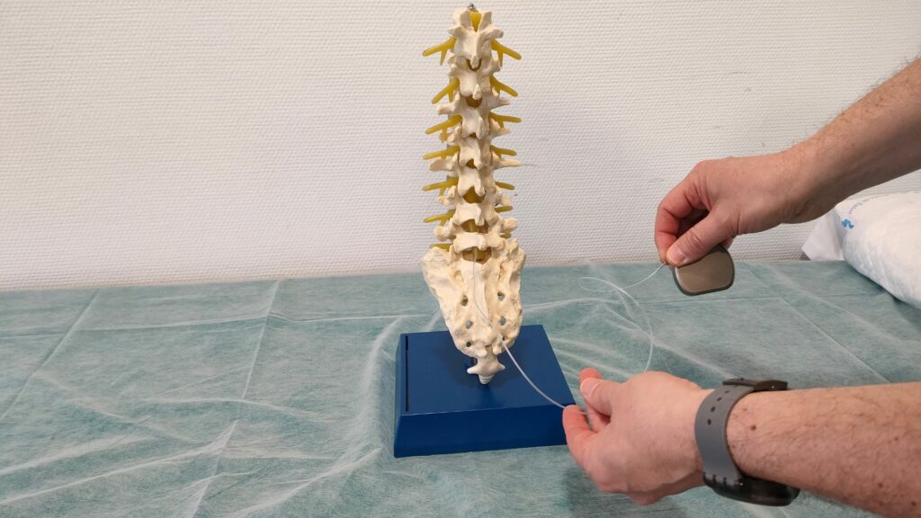 neuromodulacion severo ochoa 2