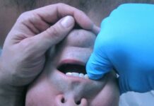 Fisioterapia Belló: los tratamientos más efectivos para los Trastornos de la Articulación Temporomandibular (ATM)