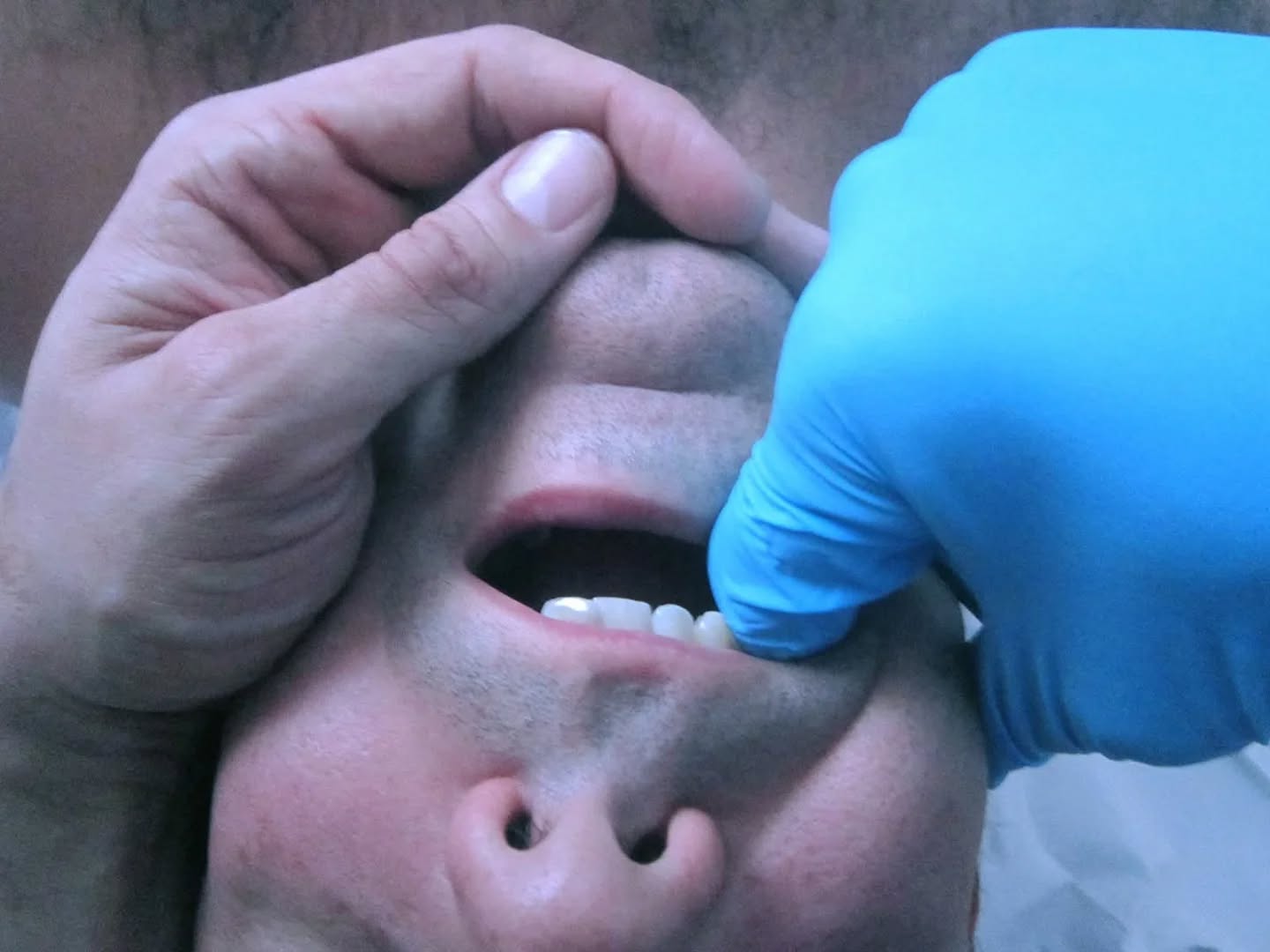 Fisioterapia Belló: los tratamientos más efectivos para los Trastornos de la Articulación Temporomandibular (ATM)